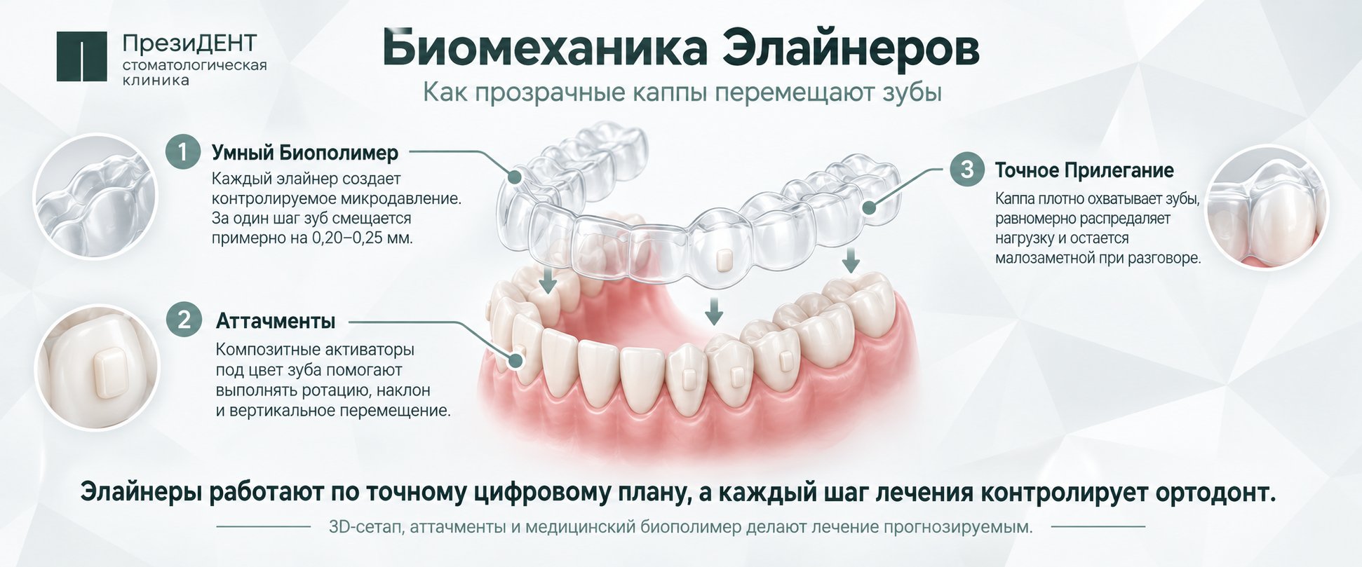 Биомеханика Элайнеров